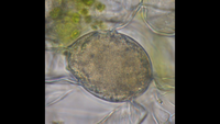 Endophytic bacteria discovered in oil body organelles of liverworts (Marchantiophyta)